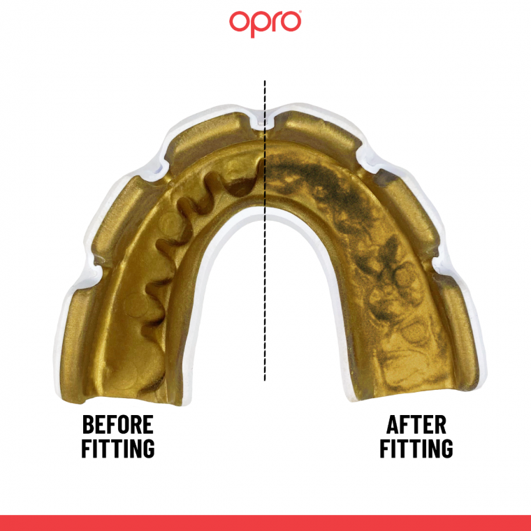 Opro Adults Instant Custom Fit Mouth Guard For Braces-White